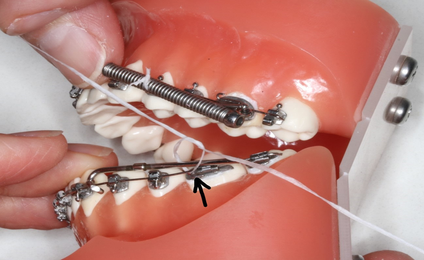 Réparation avec soie dentaire de tige métallique sortie du ressort dentaire.